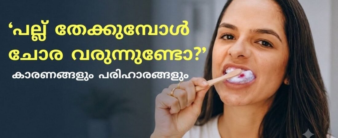 മോണയിൽ നിന്ന് ചോര വരുന്നത് എന്തുകൊണ്ട്? അവഗണിക്കരുതാത്ത കാരണങ്ങളും പരിഹാരങ്ങളും