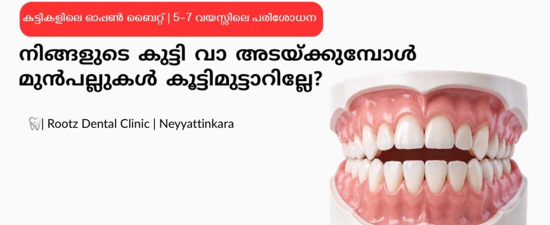 സമയത്ത് ഡെന്റിസ്റ്റിനെ കാണിച്ചില്ല; കുട്ടികളിലെ പല്ല് വിടവ് കമ്പിയിട്ടാലും മാറാത്ത അവസ്ഥയിൽ ഒരു 13-കാരി!