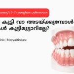 കുട്ടികളിലെ പല്ല് വിടവ് പല്ലിലെ ഓപ്പൺ ബൈറ്റ് Rootz Dental Clinic Neyyattinkara